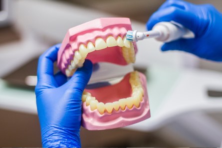 dentalhigienias-kezelesek